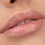5309441