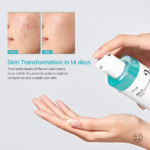 anua-us-toner-150ml-bha-2-gentle-exfoliating-toner-1161173069